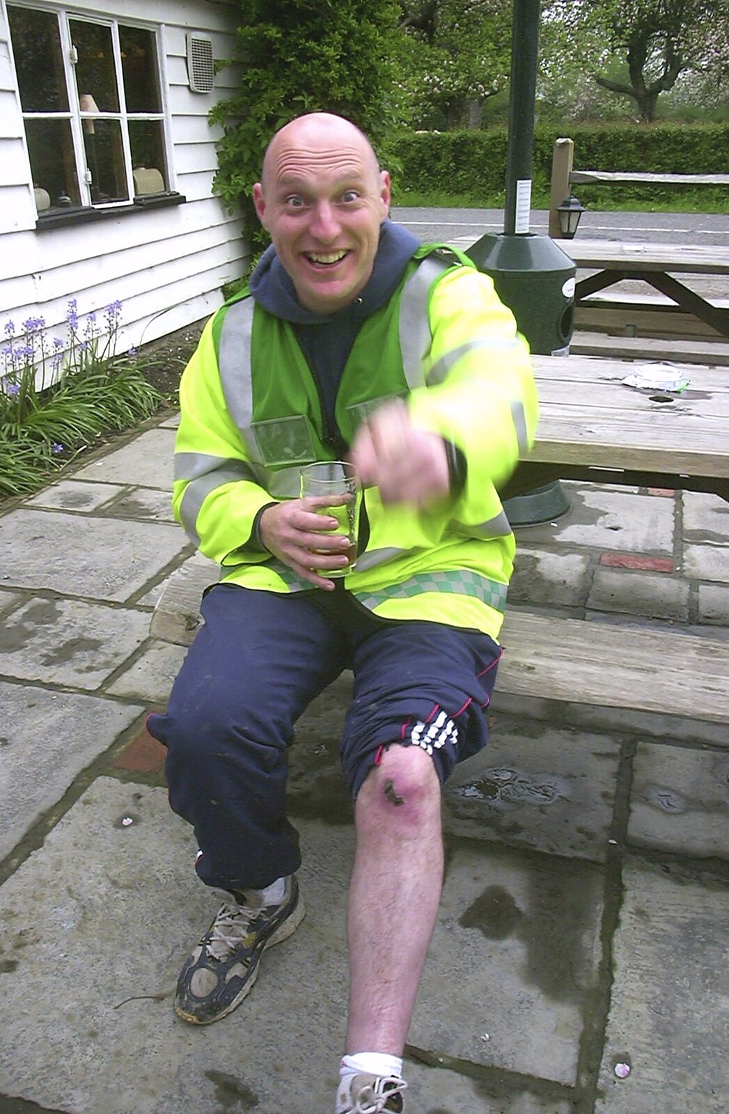 Gov shows off a scar from The BSCC Annual Bike Ride, Lenham, Kent - 8th May 2004
