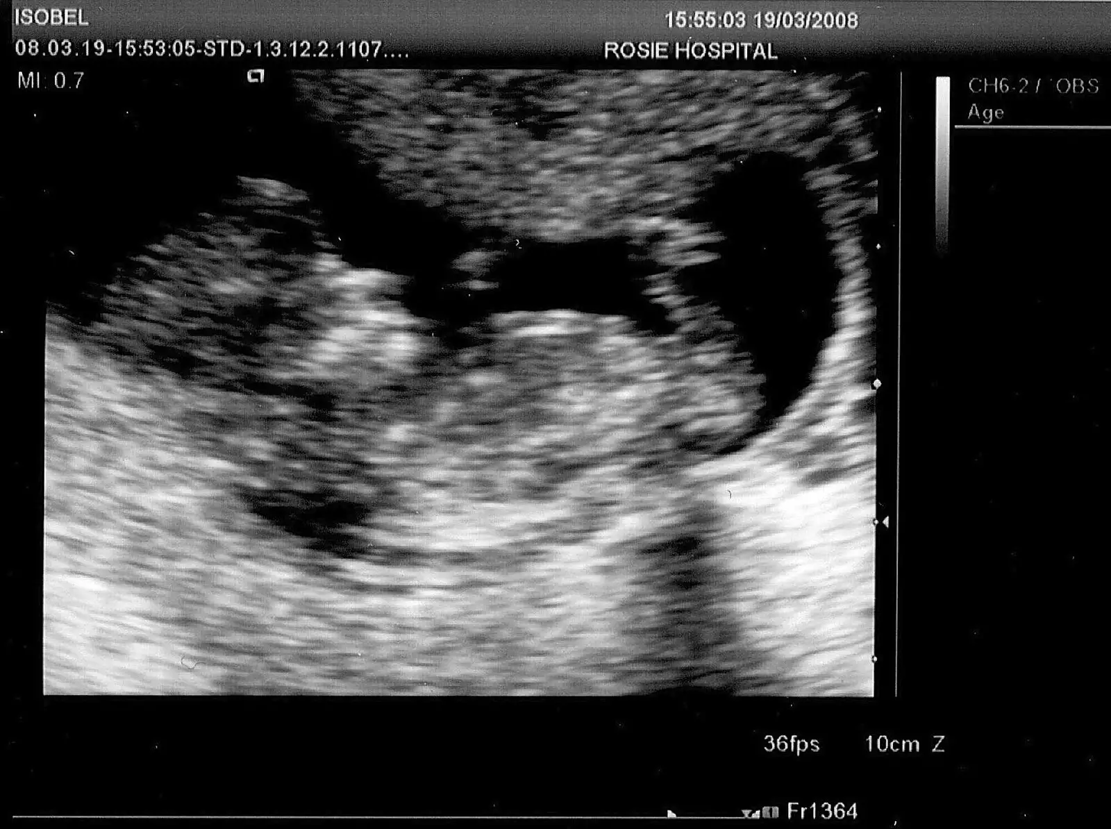 The 12-week scan, from Mother and Mike, Rachel and Sam, and the Scan That Changes Everything - 30th March 2008