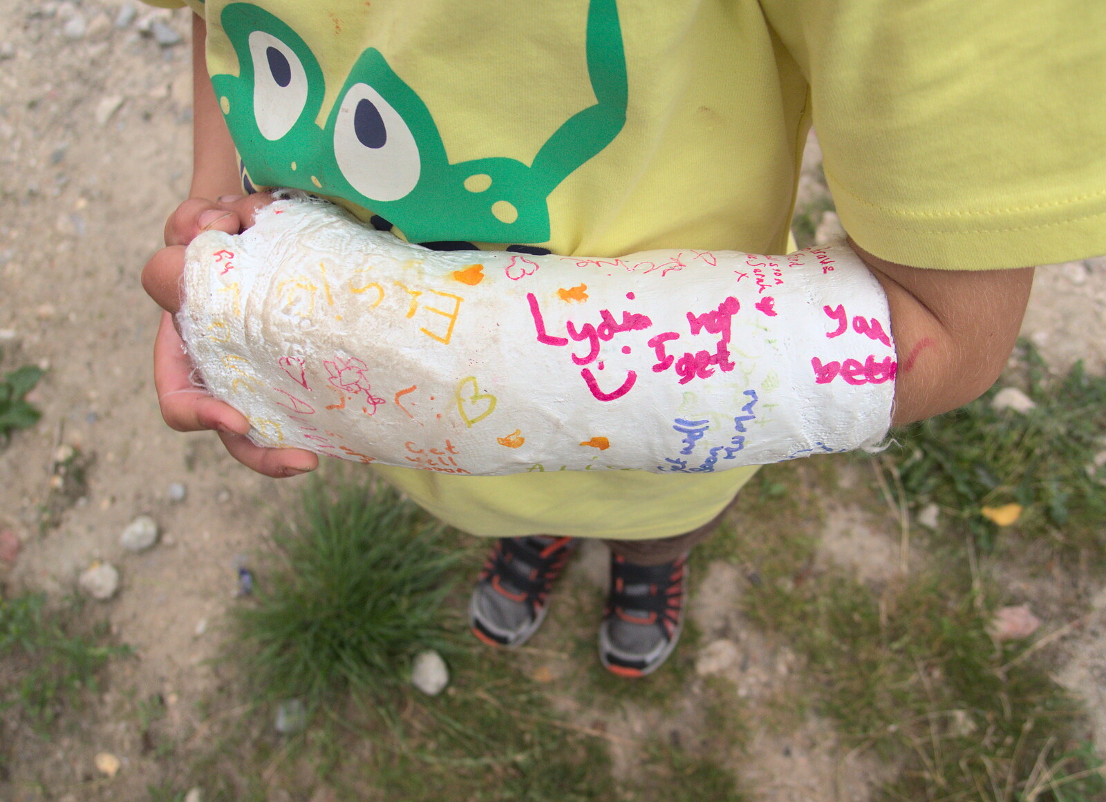 Fred shows off his signed cast from Fred's Cast and a SwiftKey Lunch, Waterloo, London - 18th August 2015
